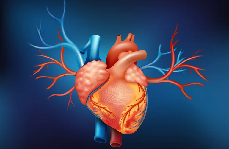 Angioplasty vs Bypass Surgery