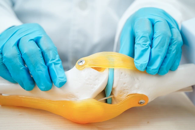 Knee Replacement Surgery