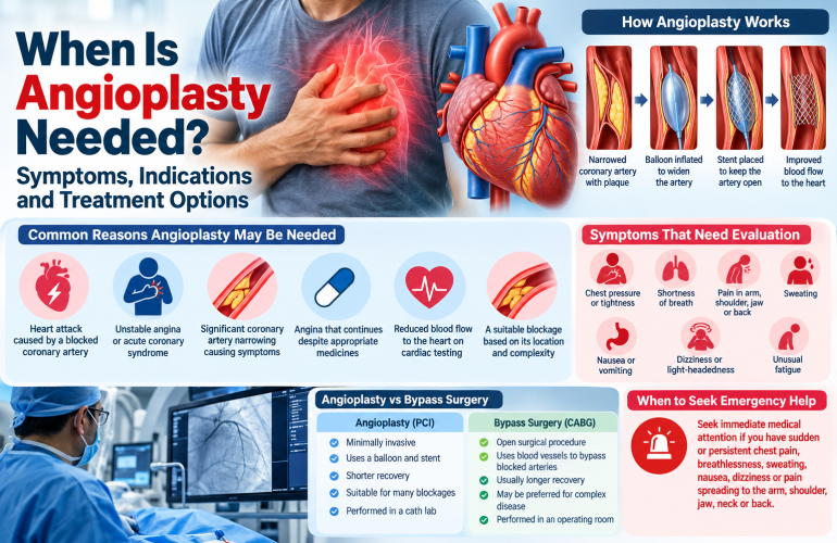 When Is Angioplasty Needed